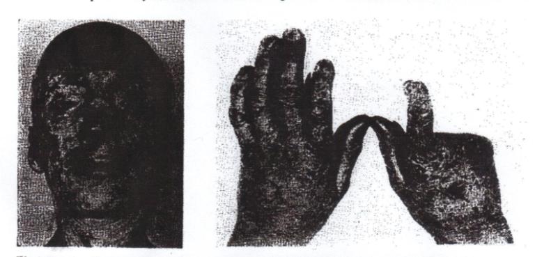 Phoryria images for appendage deformity 001