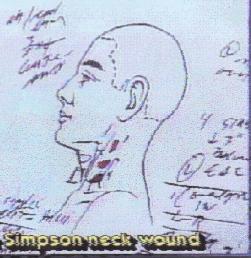 Nicole Brown Simpson stab wounds in Left side neck 001