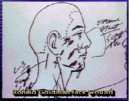 Ron Goldman photo face stab wounds