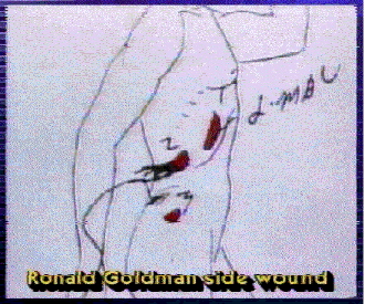 Ron Goldmans photo torso stab wounds on right side